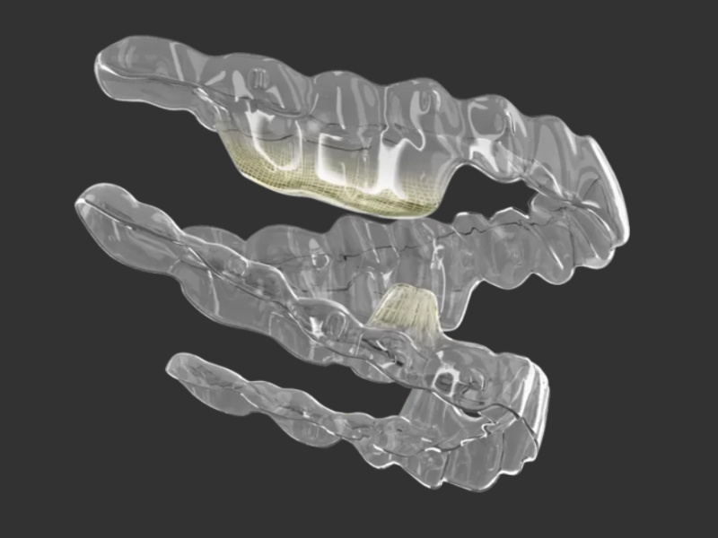 Smartee Ge Clear Aligner packages