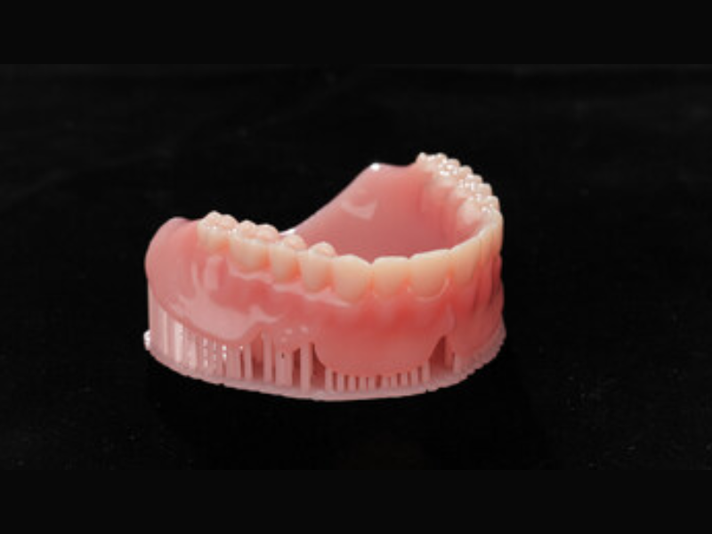 Multi-material denture (Image Courtesy: PRNewswire)
